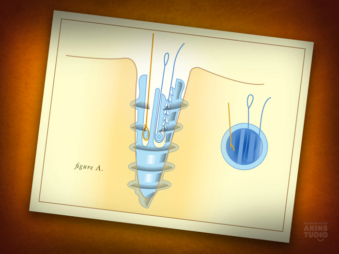 Loading Image